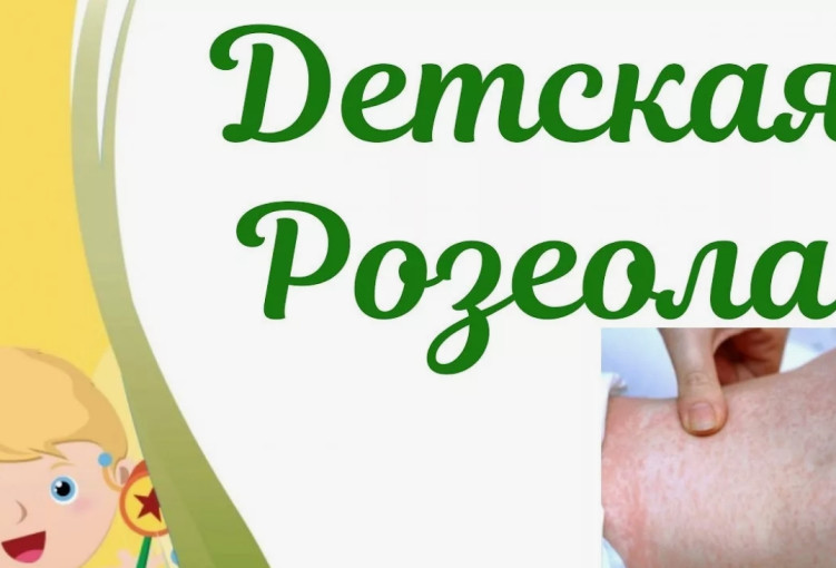 Детская розеола Детская розеола.